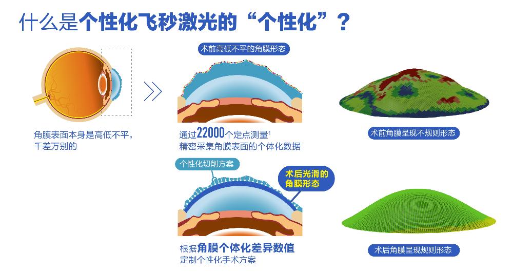個(gè)性化微飛秒